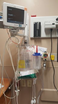 污水过滤器十大排名最新，污水过滤处理设备